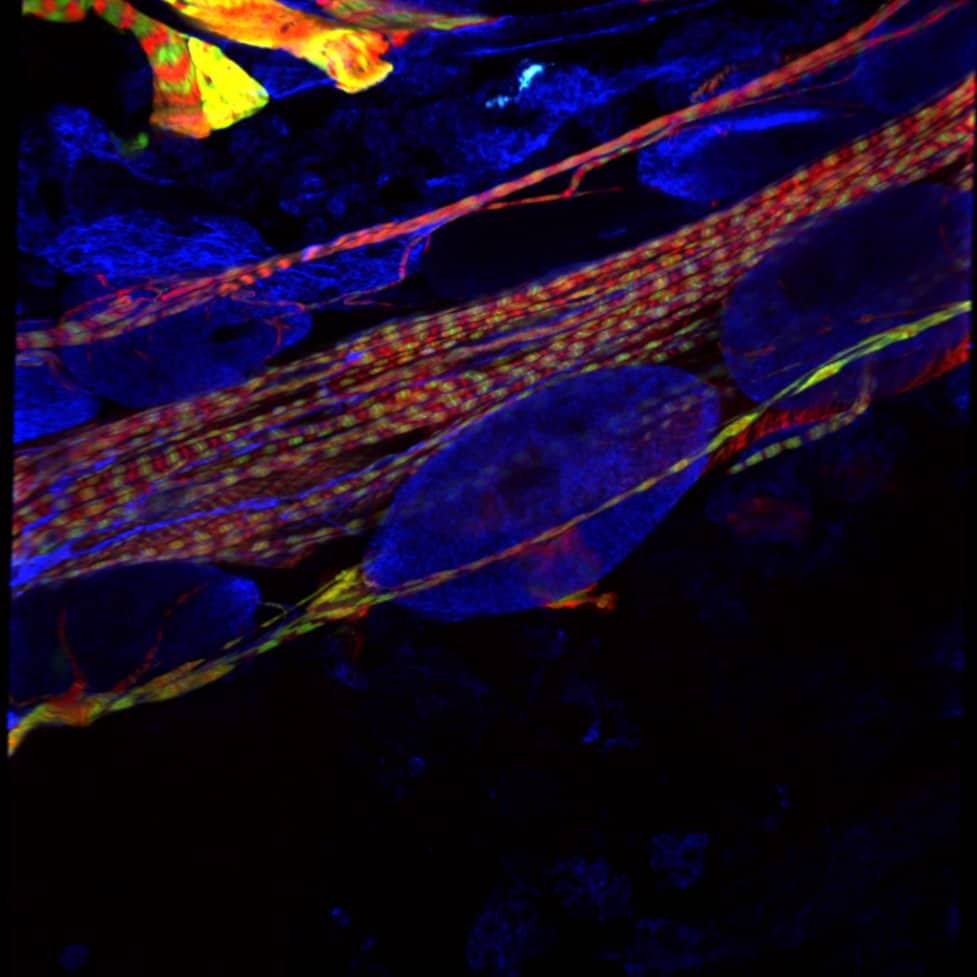 Drosophila Melanogaster heart tube stained for Actin (green), Myosin Heavy Chain (red), Alpha-tubulin (blue). Imaged on RCM2 using 40x 1.4 a objective. Sample courtesy: Pedro Espinosa Gonzalez, Amsterdam UMC, location VUMC, the Netherlands.