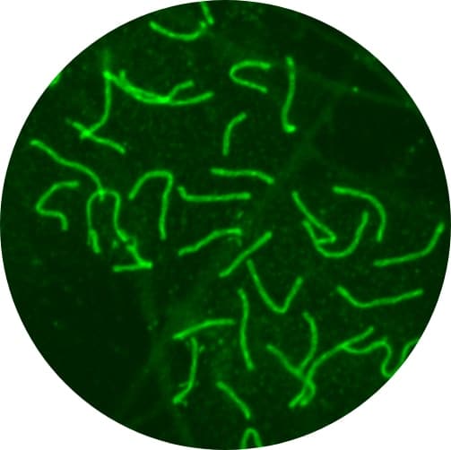 Blurry image Confocal