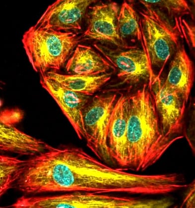 Confocal Mitosis captured with RCM2